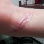 aaronwrist The cut right after gluing